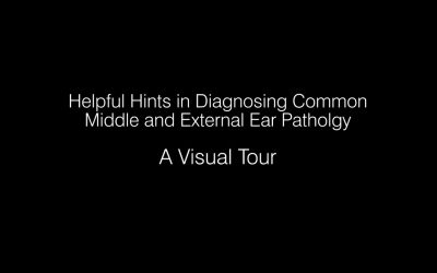 Diagnosing Common and Middle External Ear Pathology by Dr. Rick Fox, ENT.